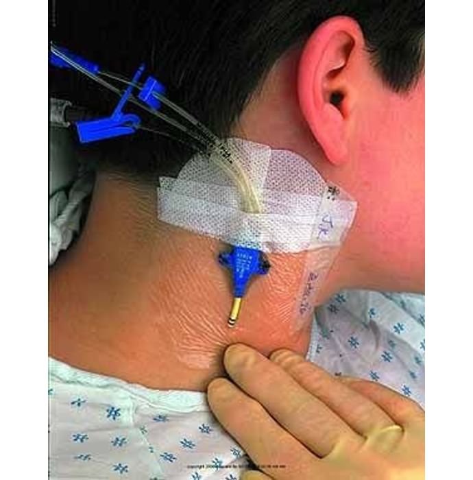 3M Tegaderm 1635 Central I.V. High Secural Dressing